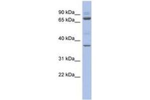 Image no. 1 for anti-Metal Response Element Binding Transcription Factor 2 (MTF2) (AA 359-408) antibody (ABIN6742455)