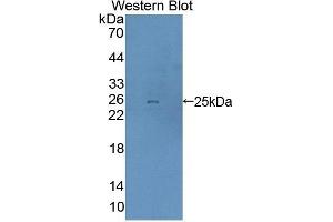 Detection of Recombinant DTNBP1, Mouse using Polyclonal Antibody to Dystrobrevin Binding Protein 1 (DTNBP1) (DTNBP1 antibody  (AA 179-319))