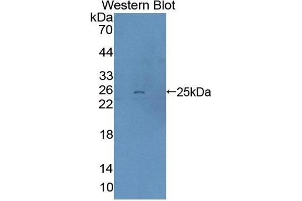 DTNBP1 antibody  (AA 179-319)