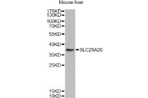 Western blot analysis of extracts of mouse liver, using SLC25A20 Antibody (ABIN6291312) at 1:1000 dilution. (SLC25A20 antibody)