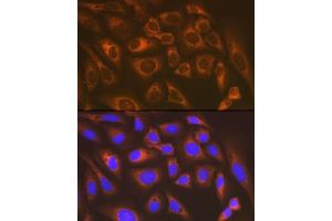 Immunofluorescence analysis of U-2 OS cells using LysRS/KARS Rabbit mAb (ABIN7268350) at dilution of 1:100 (40x lens). (KARS antibody)