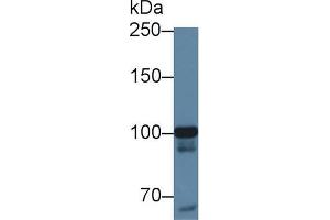 Western blot analysis of Human HeLa cell lysate, using Human MARS Antibody (1 µg/ml) and HRP-conjugated Goat Anti-Rabbit antibody (