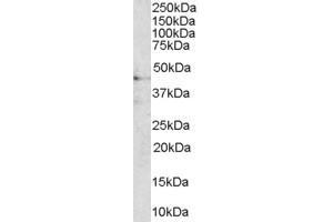Western Blotting (WB) image for anti-AT-Hook Transcription Factor (AKNA) (C-Term) antibody (ABIN2156363) (AKNA antibody  (C-Term))