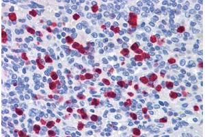 Human Spleen: Formalin-Fixed, Paraffin-Embedded (FFPE) (GCC2 antibody  (AA 1174-1185))