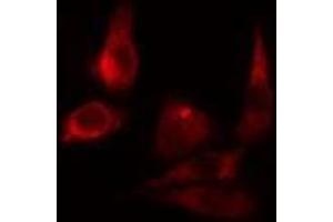 ABIN6275492 staining LOVO cells by IF/ICC. (ARHGAP9 antibody  (Internal Region))