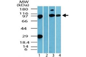 Western blot analysis of IQWD1 in human muscle tissue lysate in the 1) absence and 2) presence of immunizing peptide, 3) mouse muscle tissue lysate and 4) rat muscle tissue lysate. (DCAF6 antibody  (AA 800-850))