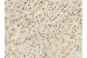 anti-Guanine Nucleotide Binding Protein (G Protein), beta Polypeptide 3 (GNB3) (C-Term) antibody