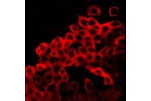 Immunofluorescent analysis of BAX staining in LOVO cells.