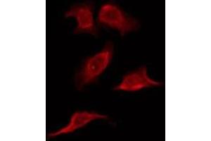 ABIN6276178 staining HT29 by IF/ICC. (OR6C2 antibody)