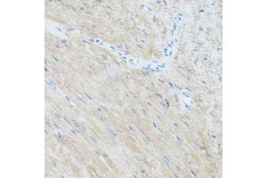 Immunohistochemistry of paraffin-embedded mouse heart using CLUH antibody  at dilution of 1:100 (40x lens).