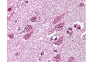 Anti-TMED10 / TMP21 antibody IHC of human brain, cortex. (TMED10 antibody  (Internal Region))