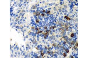 Immunohistochemistry of paraffin-embedded Rat spleen using AIMP1 Polyclonal Antibody at dilution of 1:100 (40x lens). (AIMP1 antibody)