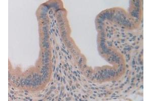 Detection of OLFM4 in Mouse Uterus Tissue using Polyclonal Antibody to Olfactomedin 4 (OLFM4)