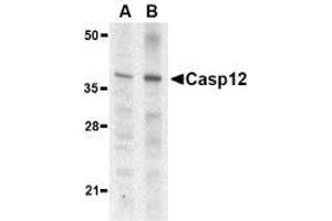 Western blot analysis of caspase-12 in mouse (lane A) and rat (lane B) liver lysate with AP30193PU-N caspase-12 antibody (small) at 1 μg/ml. (Caspase 12 antibody  (small))
