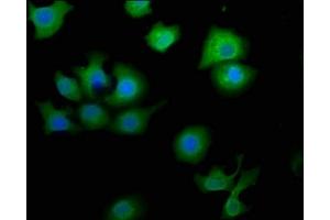Immunofluorescence staining of A549 cells with ABIN7160660 at 1:50, counter-stained with DAPI.