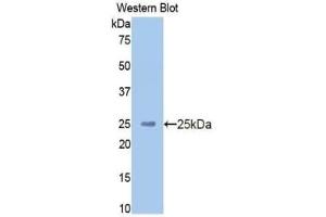 Detection of Recombinant HMWK, Human using Polyclonal Antibody to High Molecular Weight Kininogen (HMWK) (Kininogen (HMW) antibody  (AA 225-407))