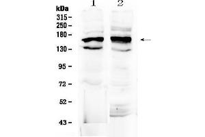 Western blot analysis of FMN1 using anti-FMN1 antibody .