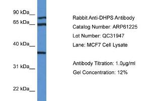 Western Blotting (WB) image for anti-Deoxyhypusine Synthase (DHPS) (N-Term) antibody (ABIN786367) (DHPS antibody  (N-Term))
