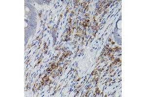 Immunohistochemistry of paraffin-embedded mouse lung using ASC/TMS1 Rabbit pAb (ABIN6131200, ABIN6146515, ABIN6146516 and ABIN6215212) at dilution of 1:150 (40x lens). (PYCARD antibody  (AA 50-195))