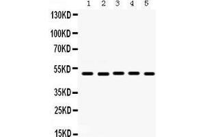 Western Blotting (WB) image for anti-Lectin, Galactoside-Binding, Soluble, 8 (LGALS8) (AA 286-317), (C-Term) antibody (ABIN3043401) (LGALS8 antibody  (C-Term))