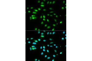 Immunofluorescence analysis of MCF-7 cells using PAX3 antibody (ABIN5970834).