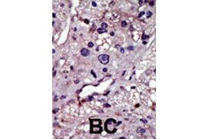 Immunohistochemistry (IHC) image for anti-Uridine-Cytidine Kinase (UCK) antibody (ABIN3003699) (UCK antibody)