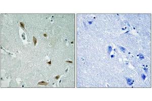 Immunohistochemistry analysis of paraffin-embedded human brain tissue using AKT1/3 (Phospho-Tyr437/434) antibody. (AKT1/3 (pTyr437) antibody)