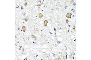 Immunohistochemistry of paraffin-embedded rat brain using RBP2 antibody at dilution of 1:100 (x40 lens). (RBP2 antibody)