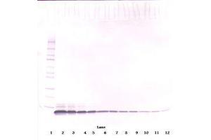 Image no. 2 for anti-Epidermal Growth Factor (EGF) antibody (ABIN465662)