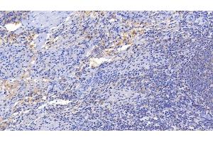 Detection of IL15 in Porcine Spleen Tissue using Polyclonal Antibody to Interleukin 15 (IL15) (IL-15 antibody  (AA 49-162))