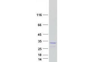 Validation with Western Blot (GSTM2 Protein (Transcript Variant 1) (Myc-DYKDDDDK Tag))