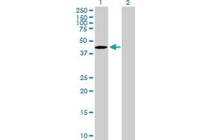 Western Blot analysis of TBC1D20 expression in transfected 293T cell line by TBC1D20 MaxPab polyclonal antibody. (TBC1D20 antibody  (AA 1-403))