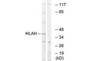 Western Blotting (WB) image for anti-Major Histocompatibility Complex, Class I, H (Pseudogene) (HLA-H) (AA 71-120) antibody (ABIN1534979)