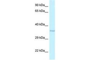 Image no. 1 for anti-Ring Finger Protein 135 (RNF135) (AA 111-160) antibody (ABIN6747466) (RNF135 antibody  (AA 111-160))