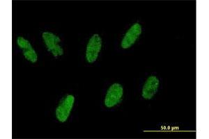 Immunofluorescence of purified MaxPab antibody to ZNF343 on HepG2 cell. (ZNF343 antibody  (AA 1-118))