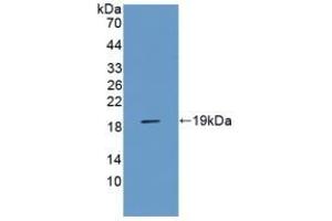 RAGE antibody  (AA 180-402)