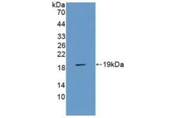 RAGE anticorps  (AA 180-402)