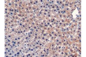 Detection of CD40L in Rat Liver Tissue using Monoclonal Antibody to Cluster Of Differentiation 40 Ligand (CD40L) (CD40 Ligand antibody  (AA 105-260))