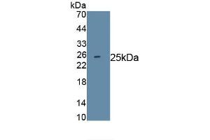 Detection of Recombinant IL18, Rabbit using Monoclonal Antibody to Interleukin 18 (IL18) (IL-18 antibody  (AA 32-192))