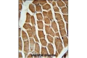 CTTB2 Antibody (N-term) (ABIN651681 and ABIN2840358) immunohistochemistry analysis in formalin fixed and paraffin embedded human skeletal muscle followed by peroxidase conjugation of the secondary antibody and DAB staining. (CTTNBP2 antibody  (N-Term))