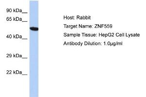 Host: Rabbit Target Name: ZNF559 Sample Type: HepG2 Whole Cell lysates Antibody Dilution: 1. (ZNF559 antibody  (N-Term))