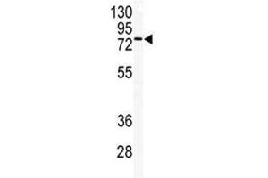 Western blot analysis of TLK2 antibody and mouse testis tissue lysate. (TLK2 antibody  (AA 141-171))