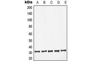 Western blot analysis of Galectin 3 expression in HeLa (A), Jurkat (B), Raw264. (Galectin 3 antibody  (Center))