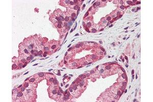 Immunohistochemistry (IHC) image for anti-Pentraxin 3 (PTX3) (N-Term) antibody (ABIN2786737) (PTX3 antibody  (N-Term))
