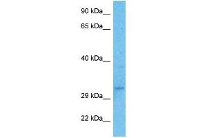 Host:  Rabbit  Target Name:  USF1  Sample Type:  Fetal Kidney lysates  Antibody Dilution:  1. (USF1 antibody  (N-Term))