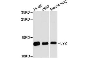 Western blot analysis of extracts of various cell lines, using LYZ antibody. (LYZ antibody  (AA 1-100))