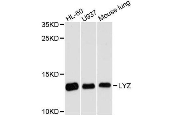 LYZ anticorps  (AA 1-100)