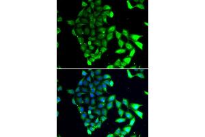 Immunofluorescence analysis of MCF7 cell using MID1 antibody.