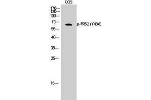 Western Blotting (WB) image for anti-Fibroblast Growth Factor Receptor Substrate 2 (FRS2) (pTyr436) antibody (ABIN3182684) (FRS2 antibody  (pTyr436))