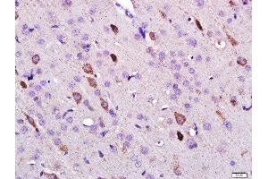 Paraformaldehyde-fixed, paraffin embedded rat brain, Antigen retrieval by boiling in sodium citrate buffer (pH6) for 15min, Block endogenous peroxidase by 3% hydrogen peroxide for 30 minutes, Blocking buffer (normal goat serum) at 37°C for 20min, Antibody incubation with 	Leptin Polyclonal Antibody, Unconjugated  at 1:500 overnight at 4°C, followed by a conjugated secondary and DAB staining. (Leptin antibody  (AA 101-154))